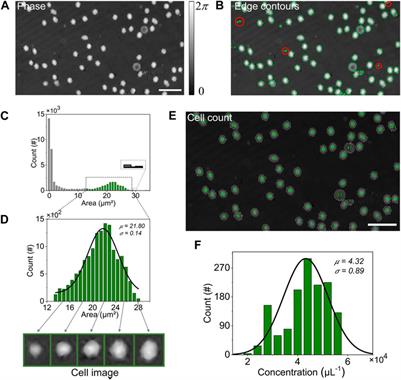 Automatic identification and analysis of cells using digital holographic microscopy and Sobel segmentation